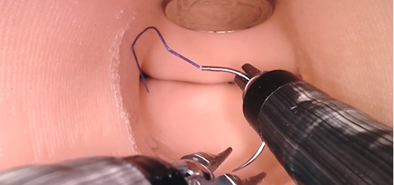 정밀 조작으로 고난도 수술까지